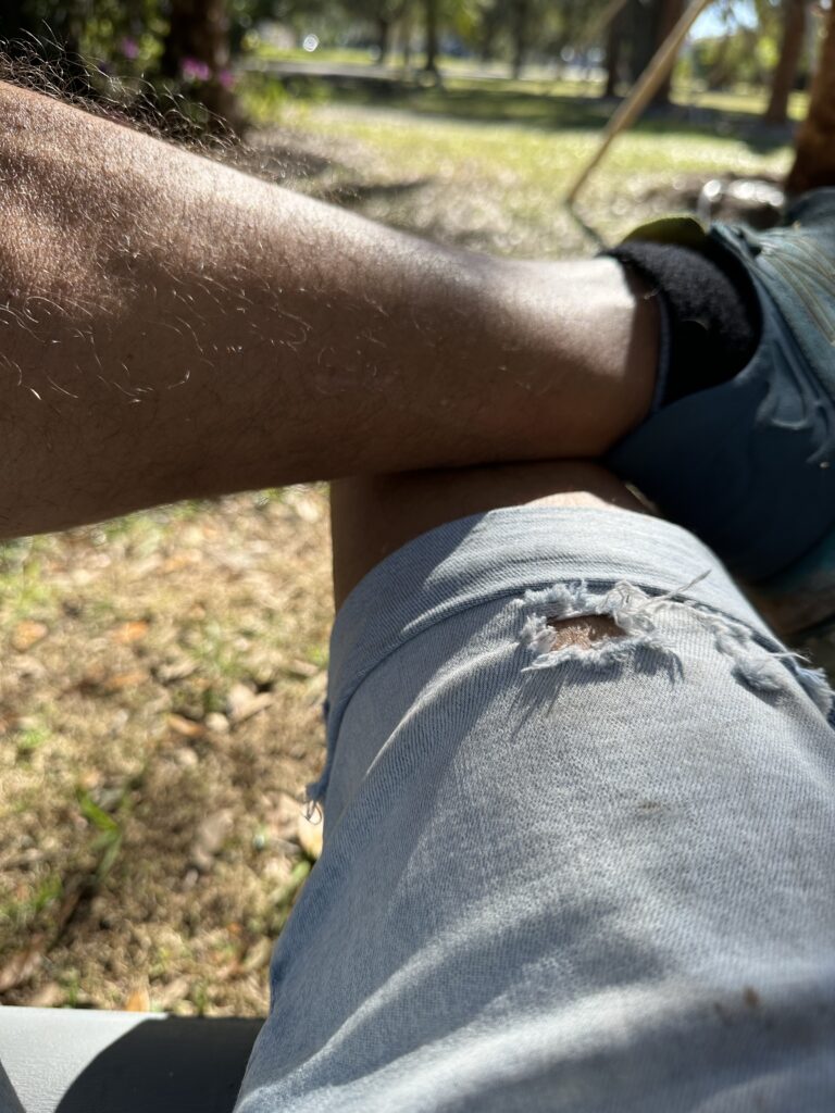 Person wearing shorts likes folded in the shade