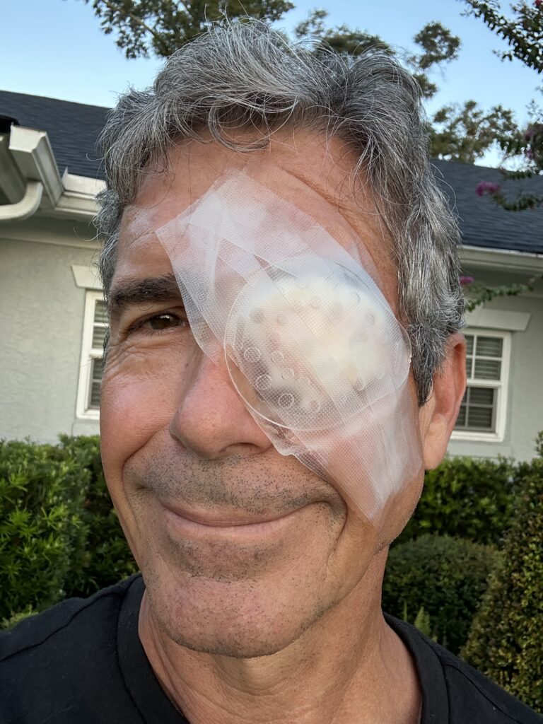Man wearing an eye surgery bandage